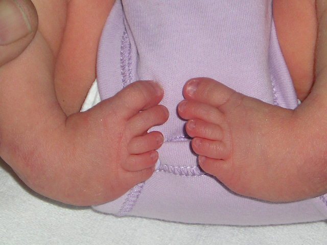CTEV Recurrence Correction