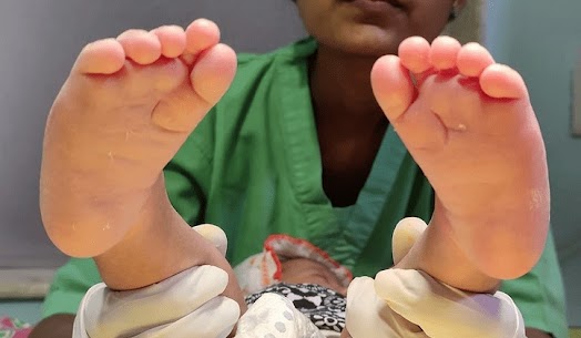 Best Pediatric Orthopedic Doctor in Noida
