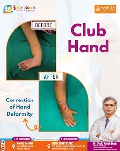 Pediatric Orthopedic Surgeon in Greater Noida