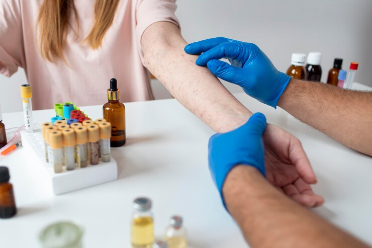 CTEV treatment in Noida