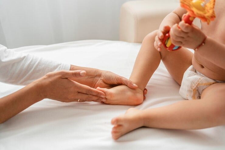 Clubfoot Treatment in Greater Noida