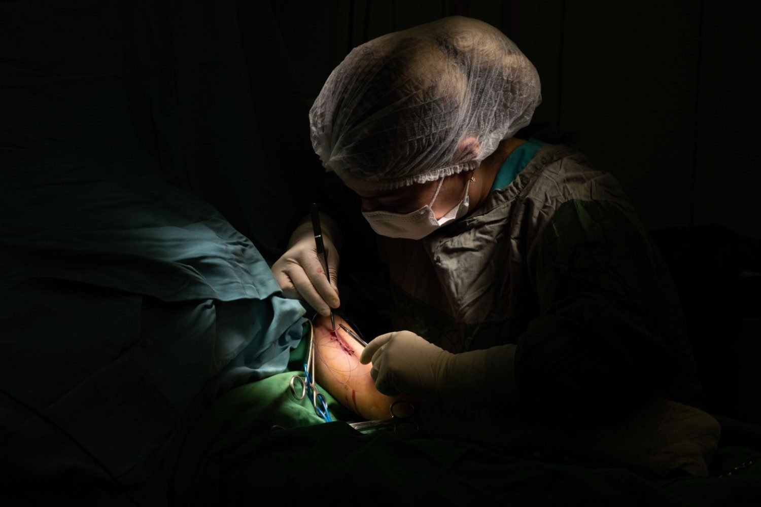 Deformity Correction Surgeon in Greater Noida